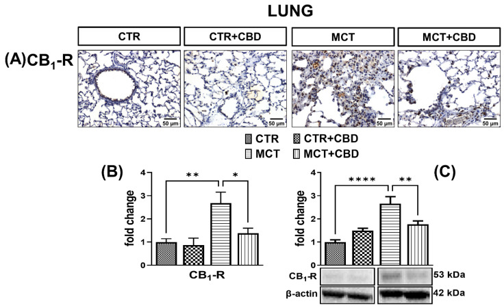 The influence of monocrotaline (MCT)-induced pulmonary hypertension and cannabidiol (CBD) or its vehicle on cannabinoid receptor type 1 (CB1-R) (A); representative micrographs of immunohistochemical staining (magnification 200×) (B) and their quantification; and (C) the density of CB1-R determined by Western blot in rats’ lungs. Bar graphs B and C illustrate the fold changes (for the relative fold change in expression in comparison to the respective CTR, whose expression level was set to 1) in the percentage area stained for CB1-R and in the density of CB1-Rs, respectively. The dark brown precipitate represents the intensity of CB1-R. CBD (10 mg/kg) or its vehicle was injected i.p. every 24 h for 21 days. Data are presented as mean ± SEM, (n = 6–7 per group); * p < 0.05, ** p < 0.01 and **** p < 0.0001, compared to the respective group.