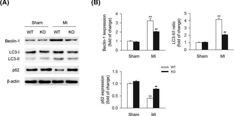 CB2R deficiency results in the dysfunction of autophagy in ischemic heart from MI miceLeft anterior descending coronary artery was permanently occluded to create MI mice model. Heart issues were isolated at 24-h postinfarction. (A) Levels of autophagy-related proteins including Beclin-1, LC3-II/I, and p62 were detected by western blot. (B) Quantitative analysis of the relative Beclin-1, LC3-II/I ratio, and p62 expression (n=five per group). **P<0.01 versus WT sham; ##P<0.01 versus WT MI.
