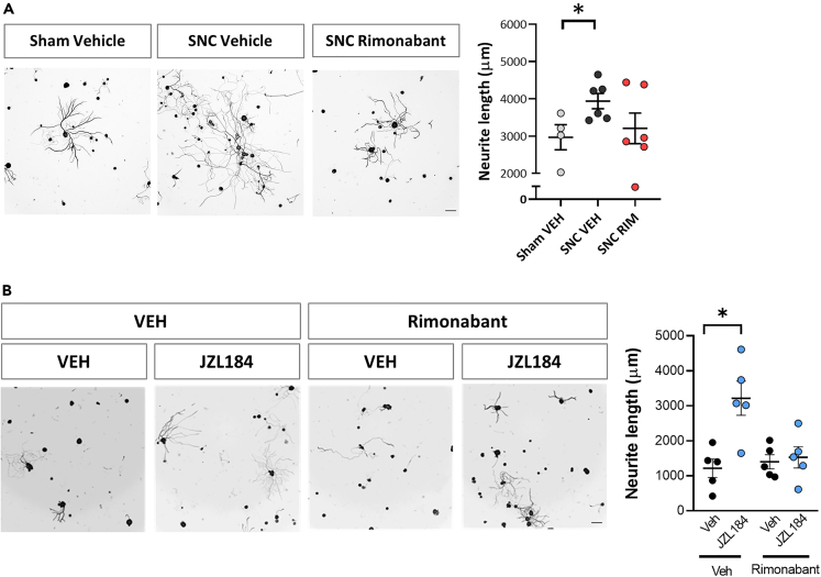Injury and 2-AG induced outgrowth is induced by CB1R activation(A) Representative images and graphs of ex vivo DRG neurite outgrowth (Tuj-1 positive cells) after in vivo sciatic nerve administration of the CB1R antagonist rimonabant (RIM) or vehicle (VEH) before sham/sciatic nerve crush (SNC) (n = 4–6 cultures from different nerves per group). (B) Representative images and graphs of in vitro DRG neurite outgrowth (Tuj-1 positive cells) 24h after VEH or CB1R antagonist rimonabant (RIM) combined with VEH or JZL184 treatments (n = 5 different wells per group). Data are expressed as mean ± S.E.M. ∗p < 0.05 denotes significant difference after ANOVA followed by Bonferroni post-hoc test. Scale bars 100 μm.