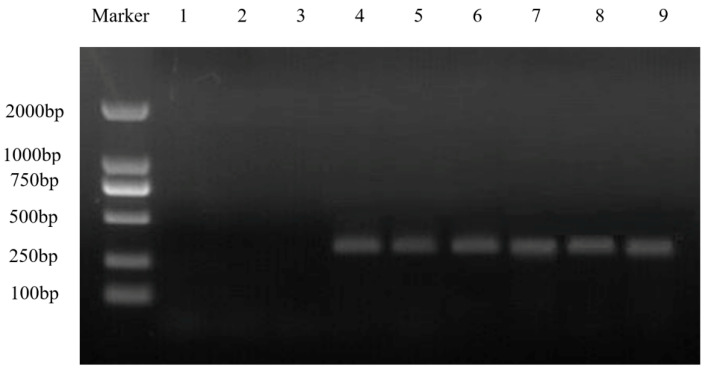 Infected plant virus expression results. Tobacco brittle virus capsid protein CP gene was not expressed in WT lines 1–3, and can be expressed normally in the negative control lines 4–6 and in MaZIP4-VIGS seedling lines 7–9. M: molecular weight markers.
