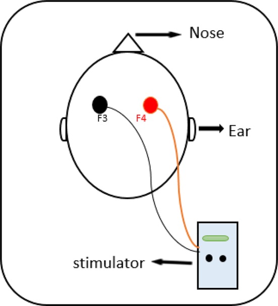 The anode was placed on the right DLPFC (F4) and cathode was placed on the left DLPFC (F3) according to the 10–20 international system for EEG.