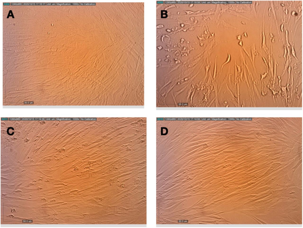 Effects of pretreatment of MRC-5 cells with terpenes and CBD on the replication and cytopathic effect of HCoV-229E. (A) Healthy MRC-5 cells, (B) MRC-5 cells that had been pretreated with assay medium, photographed 72 h after inoculation with HCoV-229E, (C) MRC-5 cells that had been pretreated with terpenes, photographed 72 h after infection with HCoV-229E, (D) MRC-5 cells that had been pretreated with terpenes and CBD, photographed at 72 h after infection with HCoV-229E.