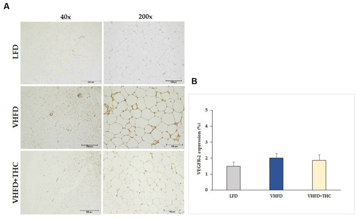 Effect of THC on VEGFR-2 expression: (A) representative VEGFR-2 expression; left column, magnification 40x; scale bar = 500 μm; right column, magnification 200x; scale bar = 100 μm; (B) %VEGFR-2 expression. Data are presented as mean ± SEM.
