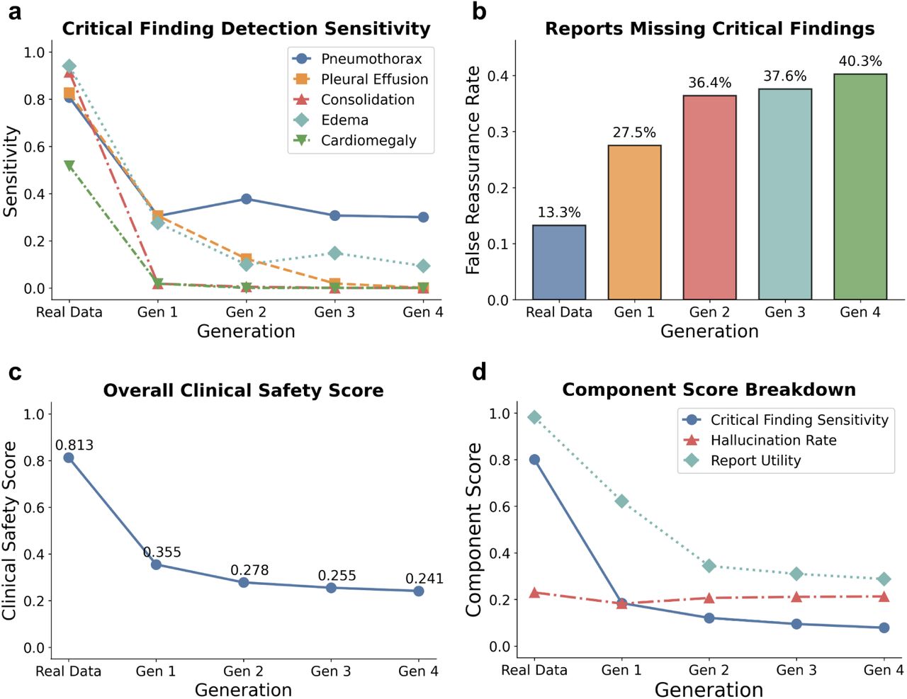 Catastrophic failure of diagnostic reliability and surge in false reassurance rates.a, Decay of critical finding sensitivity. Detection rates for pleural effusion, consolidation, edema, and cardiomegaly plummet from >80% to near-zero levels across generations, indicating the systematic erasure of pathological signals. Pneumothorax detection shows anomalous resilience, consistent with the paradox observed in lexical metrics. b, Escalating false reassurance. The rate of reports declaring "no acute findings" in the presence of confirmed pathology triples (from 13.3% to 40.3%), creating a dangerous decoupling of model confidence and diagnostic accuracy.c, Composite clinical safety score, demonstrating a 55% decline (0.843 to 0.381) relative to baseline. d, Drivers of safety degradation. Component breakdown identifies the degradation of critical finding sensitivity and report utility as the primary drivers of failure. Notably, hallucination rates remain stable, indicating that safety failure is driven by the omission of real pathology rather than the fabrication of non-existent findings.