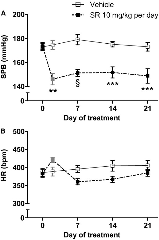 Chronic systemic CB1 receptor blockade in (mRen2)27 rats lowered SBP (A) without significantly changing HR (B) over the duration of treatment. **P < 0.01 versus Vehicle; ***P < 0.001; §P < 0.0001; n = 7–8 on Days 0, 7, 14, and 21; n = 3–4 on Day 2. Day 2 values reflect measurements made 24 h following the Day 1 treatment.