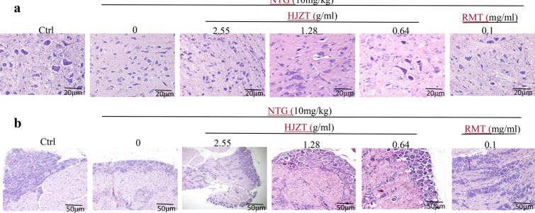 a HE staining of midbrain tissues, and B. HE staining of TG tissues