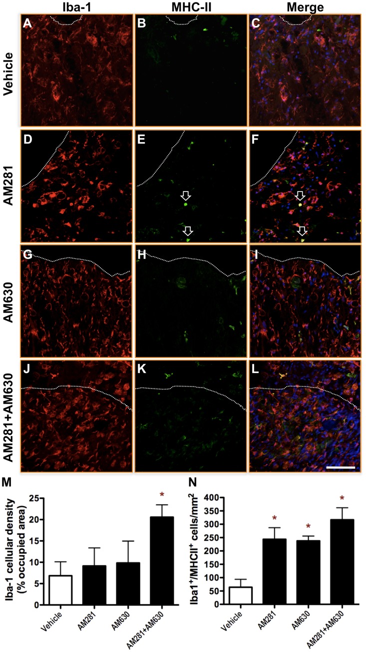 Early blockade of CB1 and CB2 receptors results in increased microgliosis 90 days after lesion.Representative micrographs of microglial reactivity in the spared ventral white matter at 90 days after lesion in vehicle- (A-C), AM281- (D-F), AM630- (G-I) and AM281/AM630-treated rats (J-L). In merge images, nuclear staining is showed in blue. Dashed lines separate spared white matter (below in the images) from cyst (above). AM281/AM630-treated rats exhibited an increased density of Iba-1+ cells. (M) Quantification of the area occupied by Iba-1 immunostaining shows a 3-fold increase in AM281/AM630-treated rats when compared to vehicle-treated rats. A small number of Iba-1+ cells expressed also MHC-II in the cyst surrounding white matter. (N) However, quantification of double positive cells shows a significant increment in the number of Iba-1+/MHC-II+ cells in spinal cords of AM281-, AM630- or AM281/AM630-treated rats. Scale bar for all images, 100 µm. *p<0.05 vs. vehicle-treated rats. Vehicle n = 6; AM281 n = 6; AM630 n = 5; AM281+AM630 n = 10.