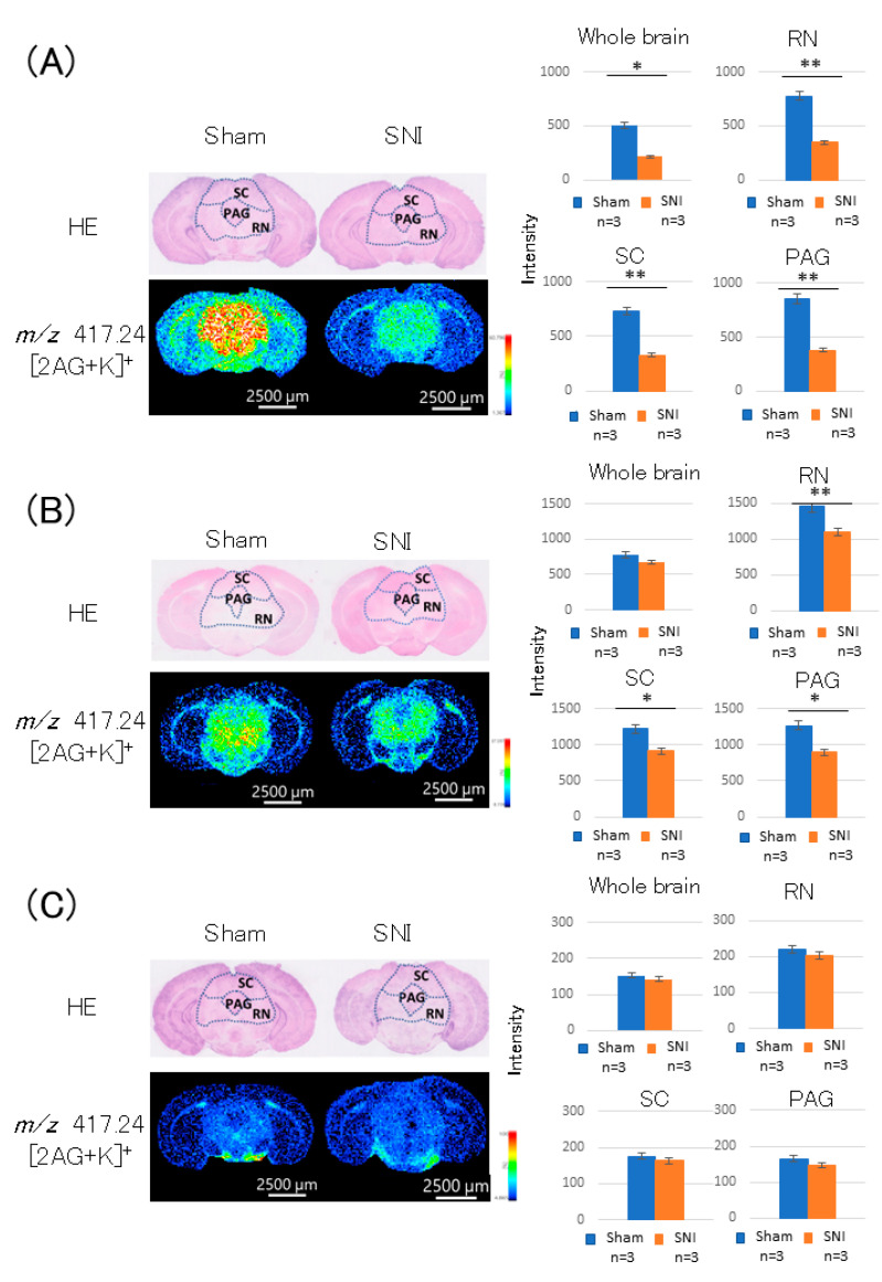 Detection of 2-AG in the PAG region of mice brains. (A) On day 3 post-treatment, 2-AG level in the whole brain was reduced in the SNI group. The difference was particularly pronounced in the midbrain; 2-AG levels in the superior colliculus (SC) and reticular formation (RN) were lower in the SNI group than in the sham group. 2-AG level in the PAG was also decreased in the SNI group. (B) On day 7 post-treatment, 2-AG level in the whole brain was reduced in the SNI group. In the midbrain, however, there was a difference in 2-AG between the two groups: 2-AG levels in the SC and RN were lower in the SNI group than in the sham group, similar to the result on day 3 post-treatment. 2-AG level in the PAG was also decreased in the SNI group. (C) On day 21 post-treatment, there was no difference in 2-AG level in the whole brain between the SNI and sham groups. There was also no difference in 2-AG levels in the midbrain and PAG between the two groups. *: p < 0.05,**: p < 0.01.