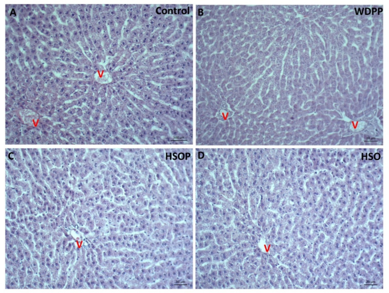 Hematoxylin and eosin (HE) stained liver sections in rats fed for 8 weeks with (A) SD; (B) WDPP; (C) HSOP; (D) HSO. V: central vein.