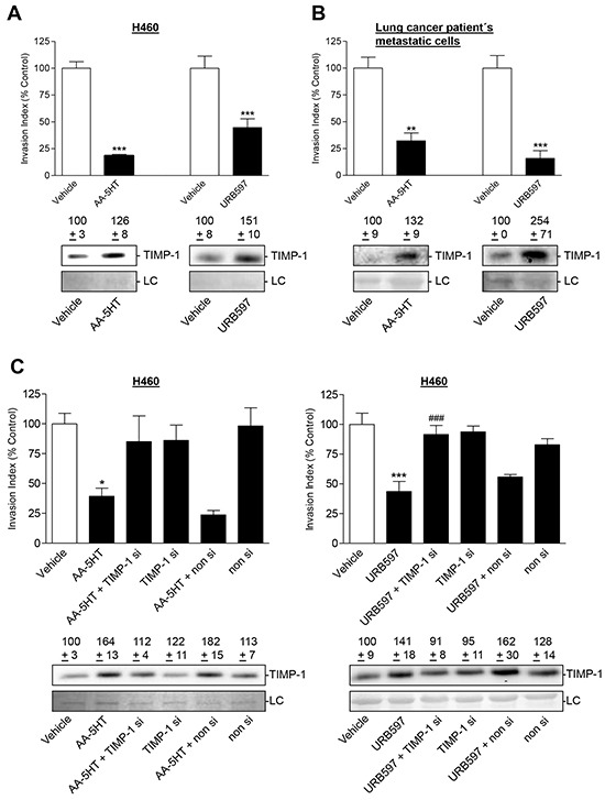 Effect of TIMP-1 knockdown on the anti-invasive and TIMP-1-upregulating action of FAAH inhibitors in other lung cancer cellsA, B. Effect of AA-5HT (10 μM) and URB597 (10 μM) on invasion and TIMP-1 expression in the lung cancer cell line H460 (A) and lung cancer patient's metastatic cells (B) following a 72-h incubation period, respectively. C. Effect of TIMP-1 siRNA on FAAH inhibitors' action on cell invasion and TIMP-1 protein levels in H460 cells. H460 cells were transfected with TIMP-1 siRNA at a final concentration of 0.25 μg/ml siRNA (si) or with non-silencing siRNA (non si) for 24 h. Subsequently, cells were placed into invasion chambers in terms of invasion assays. Following the first transfection, cells were retransfected with the indicated type of siRNA or suspension buffer to provide constant knockdown conditions, and incubated with vehicle, AA-5HT (10 μM) or URB597 (10 μM) for another 72 h. Protein staining of cell culture media is shown as loading control (LC). Numbers above the blots represent densitometric analyses of the respective Western blots. All values are expressed as percent control in comparison with vehicle-treated cells (100%) in the absence of test substance. Data are means ± SEM of n = 3 (A, left blot; B, both blots; C left blot), n = 3-4 (C, right panel, invasion), n = 4 (B, invasion), n = 6 (A, right blot; C right blot), n = 7-8 (C, left panel, invasion), n = 8 (A, left panel, invasion) or n = 12 (A, right panel, invasion) experiments. *P < 0.05, **P < 0.01, ***P < 0.001 vs. vehicle; ###P < 0.001 vs. URB597; ANOVA plus post hoc Bonferroni test (C) or Student's t test (A, B).