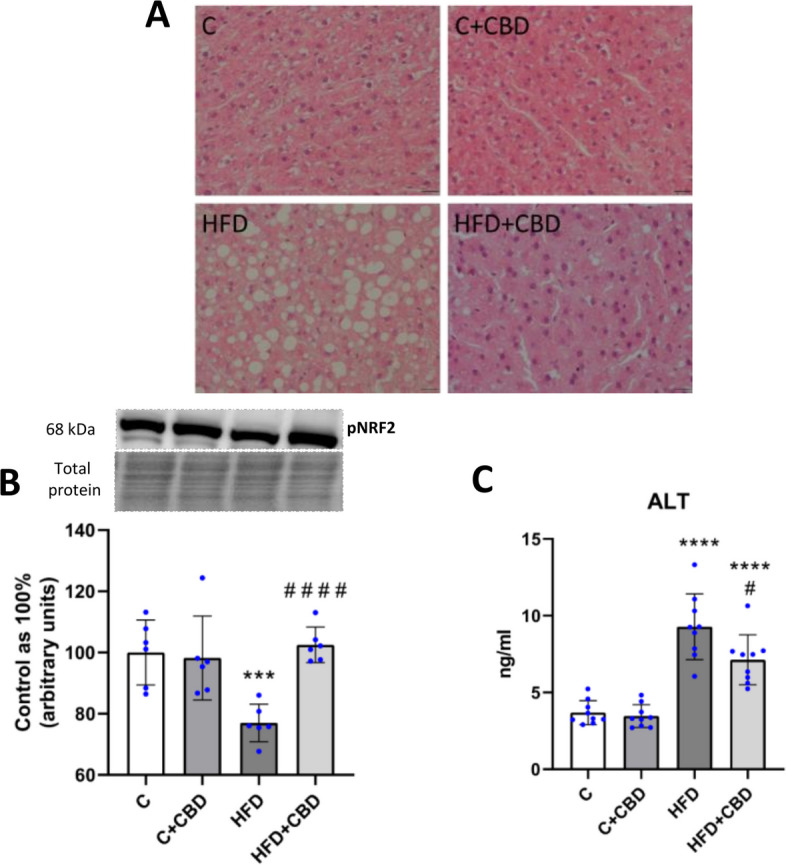 The assessment of liver function and oxidative stress marker. The representative (A) histological images of the liver, (B) the liver expression of pNRF2(Ser40) – phosphorylated at Serine 40 Nuclear factor erythroid 2-related factor 2; and (C) plasmatic concentration of ALT – alanine aminotransferase after intraperitoneal injections of CBD during the last 2 weeks of the experiment to rats fed a standard diet (C) or high-fat diet (HFD) for 7 weeks. Western blotting technique was used to measure the proteins’ expression, and the enzymes’ concentration was measured with an ELISA kit. The overall expression of the protein is displayed as a percentage difference, with 100% being the control group, and ALT concentration is expressed in ng per ml of plasma. In the histological images showing hematoxylin–eosin staining of the hepatic tissue, scale bars are 20 µm. The data is presented as mean values ± standard deviation (SD) based on six (pNRF2, histology) or nine (ALT) independent determinations in each experimental group. *–p < 0.05; **–p < 0.01; ***–p < 0.001; ****–p < 0.0001 significant change vs control group; #–p < 0.05; ##–p < 0.01; ###–p < 0.001; ####–p < 0.0001 significant change vs HFD group