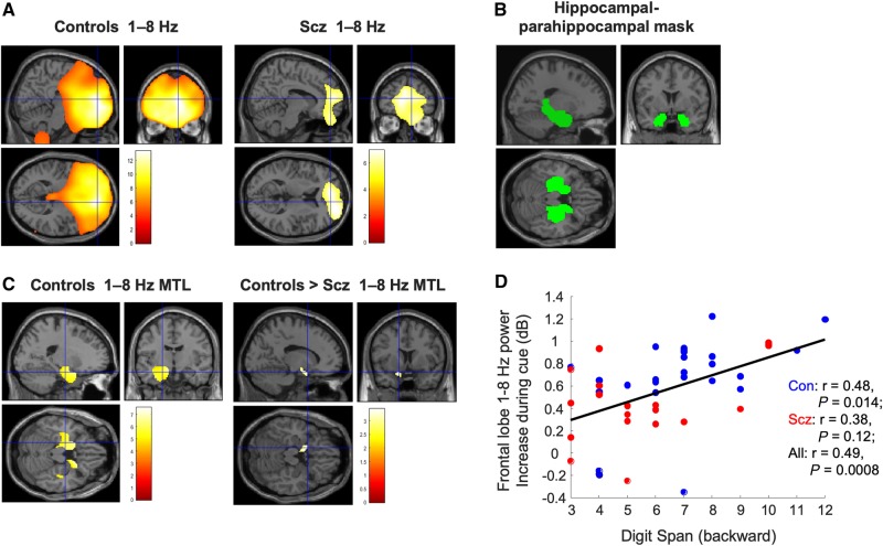 Analysis of source localized power in the spatial memory task. All results are overlaid on a canonical Montreal Neurological Institute T1 image. (A) Source localized 1–8 Hz theta power increases during the first 1.5 s of the cue period, compared to an immediately preceding 1.5 s baseline period, for controls and schizophrenia subjects (after regression of eye movement variance). Both groups exhibit significant increases centred on mPFC [controls: peak (14 54 −4), Z = 7.18, PFWE < 0.001; schizophrenia subjects: peak (22 58 12), Z = 4.73, PFWE = 0.003]. The crosshairs in each plot are at (8 52 8), the group peak and seed chosen for subsequent phase coupling analysis. Images are thresholded at PFWE < 0.05. (B) The dilated bilateral hippocampal-parahippocampal gyrus (HC + PHG) mask (Maldjian et al., 2003) used for all mTL small volume correction analyses. (C) Source localized 1–8 Hz theta power increases during the cue period within the HC + PHG mask. Controls showed a large increase in anterior mTL theta power bilaterally (following eye movement regression), particularly on the left [left peak at (−12 0 −12), Z = 5.15, PFWE(SVC) < 0.001, right peak (20 18 −34), Z = 5.42, PFWE(SVC) < 0.001]. Image is thresholded at PFWE < 0.05. Subjects with schizophrenia showed a much smaller increase on the right side (not shown); and control subjects showed a significantly greater increase than schizophrenia subjects on the left [peak (−14 8 −18), Z = 3.21, PFWE(SVC) = 0.019]. The image is thresholded at Punc < 0.005 for display purposes. (D) Relationship between frontal lobe cue-related 1–8 Hz power increase and performance on the more demanding (backward) condition of the Digit Span across participants.