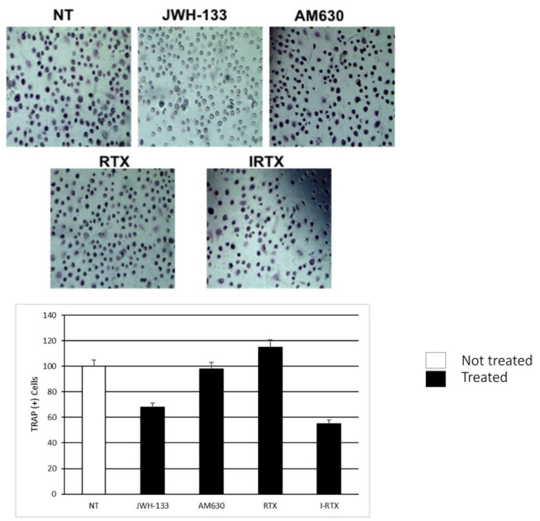 Comparison of the TRAP assay, performed on 2 OCs of patients with PBD, in the untreated (NT), JWH-133 AM630, RTX and IRTX treated samples. The most representative images are displayed. The percentage number of TRAP (+) cells with respect to the total cells number for each sample is presented in the histogram as mean ± SD.