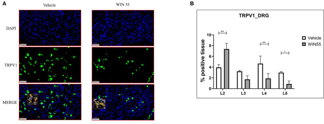 Cannabinoid receptor stimulation alters TRPV1 expression in the dorsal root ganglia of mice with endometriosis. Lumbar region DRG from L1 to L5 were analyzed for TRPV1 expression through immunofluorescence. (A) Representative images of blue (DAPI positive) and green (TRPV1 positive) channel and merged (DAPI and TRPV1 positive) layers show TRPV1 expression in DRG isolated from both vehicle and WIN 55 treated animals. (B) Statistical analysis of TRPV1 expression showed increased abundance in L2 of DRG isolated from WIN 55 treated mice, whereas L4 and L5 DRG showed significantly reduced expression when compared with mice treated with vehicle. The orange box within the immunofluorescence images represents the analysis used in this study. Scale bar 100 μm. Ordinary two-way ANOVA with Sidak post-hoc. *P < 0.05 ***P < 0.001.