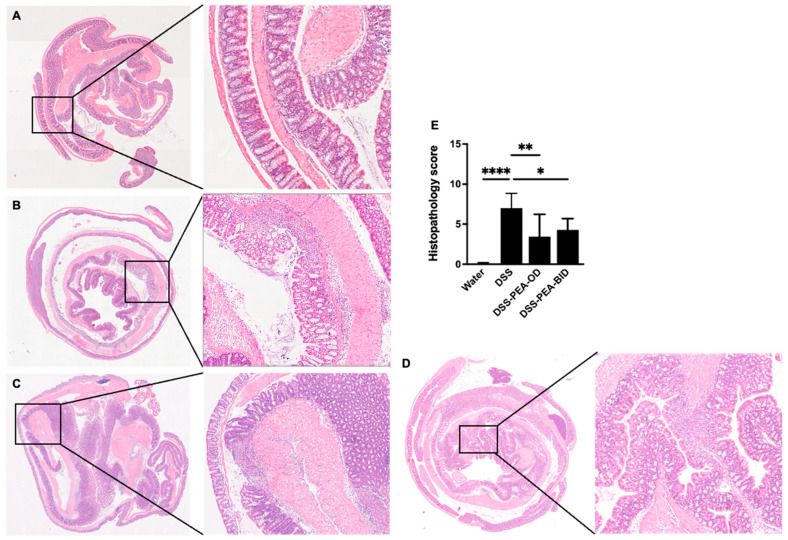 PEA treatment reduces histopathological alterations in mouse colons. Hematoxyline and eosin staining of colon tissues of mice administered either (A) water or (B) DSS 4% or DSS mice treated with (C) PEA, OD or (D) PEA, BID. (E) Histopathological scores of colon tissues of mice. Data are represented as means ± SEMs; N = 8–10. * p < 0.05, ** p < 0.01, and **** p < 0.0001 using one-way ANOVA with a post hoc analysis.