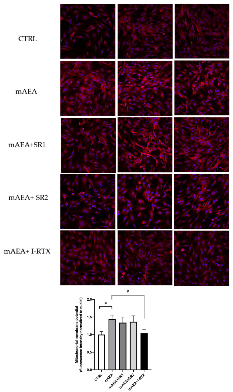 Role of eCB receptors on mitochondrial activity induced by 5 µM mAEA in C2C12 myoblasts. Confluent serum-starved C2C12 myoblasts were treated with 5 μM mAEA for 24 h in the presence of eCB receptor antagonists (SR1, SR2 or I-RTX). The fluorescence intensity of Mitotracker Red CMX-Ros (Ex/Em: 579/599) was normalized to cell number, and data are reported as mean ± SEM of six field per condition in each of the three independent experiments. Statistical analysis was performed by ONE-WAY ANOVA [* p < 0.05] and TWO-WAY ANOVA [# p < 0.05] followed by Bonferroni post-hoc test.