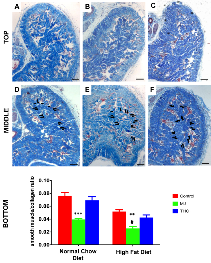 The effect of diet and oral MJ extract on the smooth muscle cell to collagen ratio in mice corpora cavernosa. Cross-section microphotographs of halved mice corpora cavernosa. Top panel: A: Control NCD; B: NCD + MJ; C: NCD + THC; Middle panel: D: Control HFD; E: HFD + MJ; F: HFD + THC. Black arrows point to areas of new collagen deposition (increased areas of blue filling in sinusoids). Bottom panel: Quantitative analysis (QIA) of histological observations expressed as smooth muscle cells(SMCs)/collagen ratio mean ± SEM: NCD + MJ vs NCD (∗∗∗P < .001), HFD + MJ vs HFD (∗∗P < .01), and HFD + MJ vs NCD + MJ (∗∗#P < .05). No statistical significance was computed in NCD + THC and HFD + THC compared to the respective control NCD or HFD groups. Magnification = 100×; 1 bar = 100 μm.