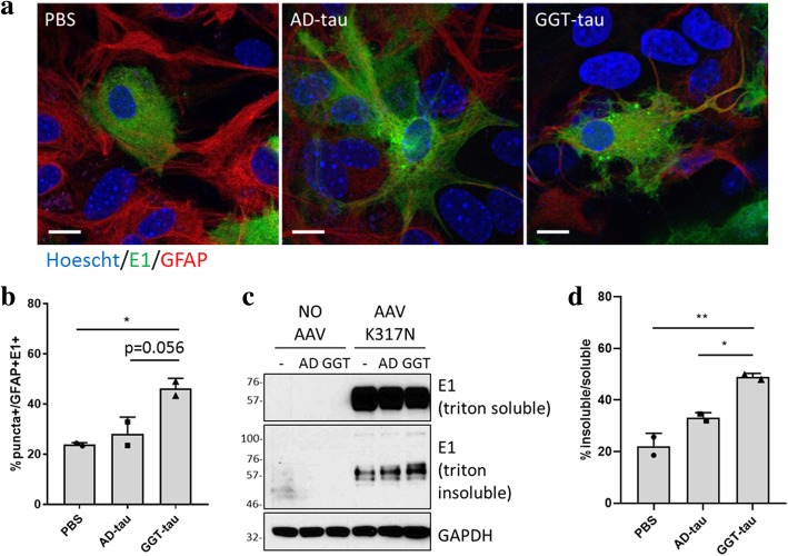 Sarkosyl-insoluble GGT-tau promotes intracellular tau aggregation in primary mouse astrocytes. a Representative confocal images showing primary mouse astrocytes transduced with AAV-TauK317N and subsequently treated with sarkosyl-insoluble GGT-tau or AD-tau for comparison. E1 staining for human tau is in green and GFAP staining for astrocytes is in red. Nuclei were stained with Hoechst (scale bar = 10 μm). b Quantification of percentage of astrocytes that are transduced with AAV-TauK317N and display tau seeding-like puncta (*p < 0.05). c-d Changes in the level of tau aggregation in AAV-transduced astrocytes upon treatment with either sarkosyl-insoluble GGT-tau or AD-tau were detected by Western blot (c) and quantified based on band intensity (*p < 0.05; **p < 0.01) (d)