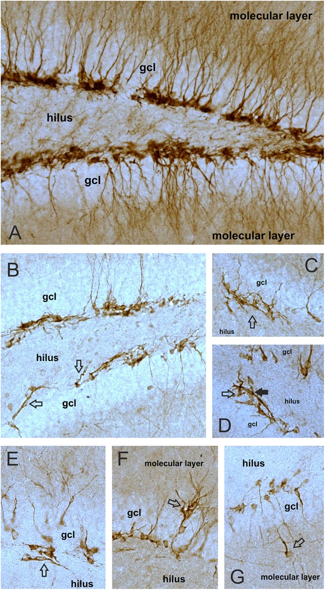 Long-term cannabis exposure alters the morphology of DCX-positive neurons. Representative images demonstrating DCX+ immature neurons with normal appearance in a control animal (A) and cells with abnormal morphology in cannabis treated mice (B–G). (A) In control mice almost all the DCX+ neurons were located in the subgranular zone, i.e., in a cell layer between the hilus and granule cell layer (gcl). Normal DCX+ cells had DCX-expressing dendrites projecting through the gcl and arborized in the molecular layer. The principal dendrites were typically running parallel to each other in the gcl giving an orderly, well-aligned appearance to the neurons. (B) DCX+ neurons in the cannabis treated animals often lost their dendritic DCX-expression. Arrows point to neurons with abnormal dendritic projections into the hilus. (C) DCX+ neurons with dendrites projecting into all directions, giving a disorganized, chaotic appearance to the neurons. (D) Open arrow points to a neuron with basal dendrites, i.e., with dendritic projections into the hilus. Black arrow points to a cell with bipolar appearance. (E) A bipolar DCX+ neuron in the hilus with dendritic projections running parallel to the gcl. (F) Neurons migrating out of the gcl into the molecular layer. (G) An ectopic DCX+ neuron with basal dendrite that migrated completely out of the gcl into the molecular layer. All images were taken with the same magnification (20× objective).