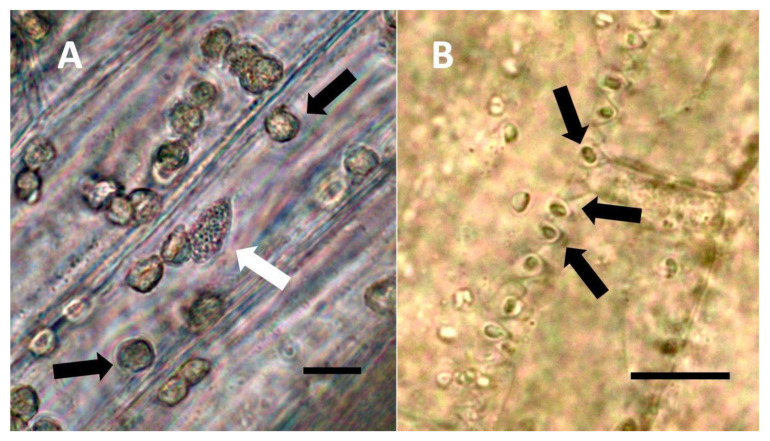 Festuca rubra leaf cells showing bacteria within non-photosynthetic cells. (A) Leaf sheath mesophyll cells stained with acidified diphenylamine to show nitrate (purple color) around bacterial masses (black arrows) and in nucleus (white arrow) (Bar = 10 µm). (B) Developing grass epidermal cells stained with nitro blue tetrazolium to show superoxide (blue color) around bacteria (arrows) accumulating in the serrate lateral walls of the cells (Bar = 10 µm).