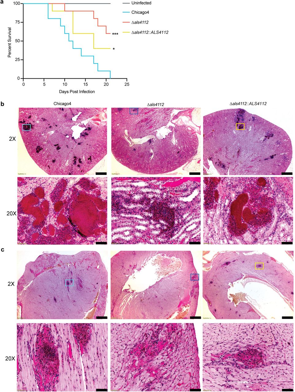 Als4112 promotes C. auris virulence during systemic infection.(A) Immunosuppressed mice were infected intravenously with 5 × 107 C. auris cells. Ten infected mice for each group were monitored for survival for 21 days. (B) Kidney and (C) Heart of the C. auris-infected mice were sectioned and stained with H&E. Stained slides were imaged at 2X and 20X resolution using Olympus bright field microscopy. The lower panel for each organ represents the magnified area of colored boxes from 2X panel. Scale bar, 500 μm (2X) and 50 μm (20X). Statistical differences were determined using Log-rank (Mantel-Cox) test (A); *P ≤ 0.05; ***P ≤ 0.001.