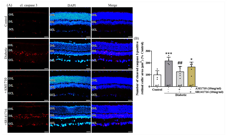 Effect of cannabinoid treatment on cl. caspase-3 dependent apoptosis in the diabetic retina. (A) Representative photomicrographs of cleaved caspase-3 immunoreactivity (cl. caspase 3-IR). Magnification: 20×. Scalebar: 50 μm. (B) Quantification studies of cl. caspase 3-IR: Diabetes induced an increase in apoptotic caspase 3+ cells in the INL of diabetic rats (*** p = 0.0004 compared to Control). AM1710 reversed the diabetes effect (## p = 0.0038 compared to diabetic untreated, p > 0.05 compared to Control). SR141716 (had no effect (p > 0.05 compared to diabetic untreated, * p = 0.0308 compared to Control, p > 0.05 compared to AM1710). Data are expressed as mean ± S.D and presented in a form that combines a bar diagram and scatter dot plot, with every dot representing a different value. One-way ANOVA was employed for the statistical analysis of all data, followed by Tukey’s multiple comparison test. Differences were considered statistically significant when p < 0.05.