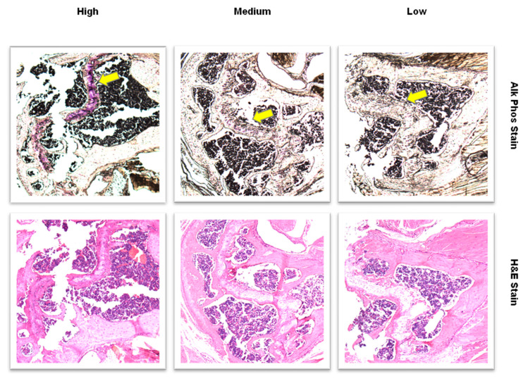 Histology images (10× magnification) of humerus sections at the distal epiphyseal plate from 3 mice. Purple areas identified with arrows show alkaline phosphatase staining of osteoblasts (top row). The images illustrate sections with high, medium and low staining. Hematoxylin and eosin-stained (H&E) images show cell structures within the sections (bottom row).