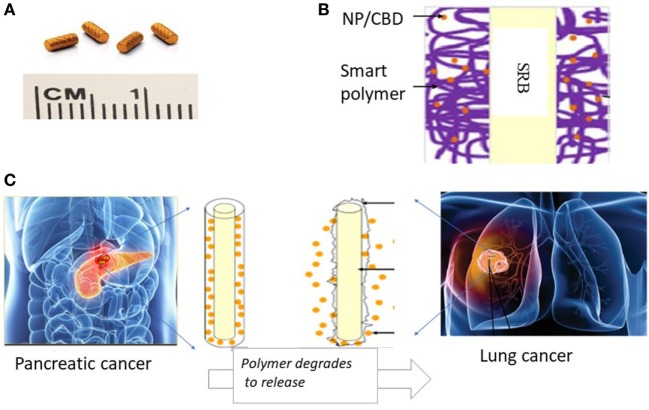Illustration of innovative approach with potential to significantly enhance therapeutic efficacy using cannabinoids (CBDs). (A) Currently used commercially available inert radiotherapy (RT) biomaterials, e.g., fiducials (CIVCO Medical); (B) one design of multifunctional biomaterial [smart biomaterial (SRB)] made of Food and Drug Administration-approved biocompatible biodegradable polymer loaded with a payload of CBDs; (C) potential clinical translation pathway is envisioned where the smart SRB could simply replace the inert biomaterials currently used for image-guided RT. Such replacement would come at no additional inconvenience to cancer patients. Once in place the SRB can be activated to sustainably release its payload as the polymer coating degrades for greater effective tumor cell kill working in synergy with RT as highlighted by our study results.