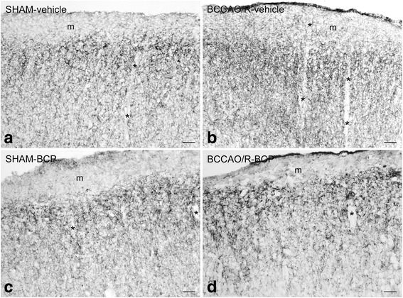 CB1-like immunoreactivity in frontal cortex coronal sections of sham-operated and bilateral common carotid artery occlusion followed by reperfusion (BCCAO/R) rats pre-treated with either the vehicle alone (a, b) or beta-caryophyllene (BCP) (c, d). Panels are representative of observations carried out in 6 rats for each group. Asterisks (*) point to blood vessels. m, molecular layer. Scale bars: 50 μm