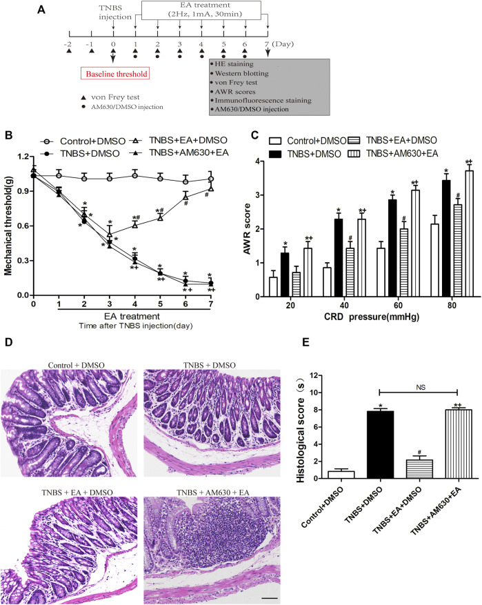 Pharmacological blockade of CB2 receptors reverses the EA’s effects on TNBS-induced visceral hypersensitivities and colonic morphology. (A) Experimental protocol show treatment schedule of AM630, the specific CB2 receptor antagonist. (B) Time course effect of AM630 treatment on the EA’s antinociceptive effect on TNBS-treated mice. (C) AWR scores of TNBS-treated mice on day 7. (D) Representative H&E staining of colon tissue sections. Scale bar, 200 µm. (E) Histological score in each group (n = 6 per group). *p < 0.05 versus with Control + DMSO group, #p < 0.05 versus with TNBS + DMSO group, +p < 0.05 versus with TNBS + EA + DMSO group. NS: no significance versus TNBS + EA + AM630 group as indicated.