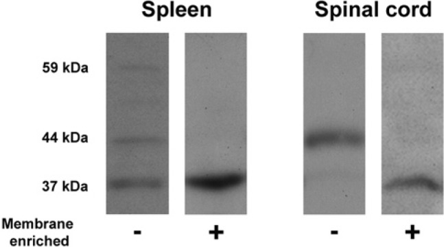 Western blot analysis of rat spleen and lumbar spinal tissue using a CB2-directed antibody. Using a standard western blot sample preparation methods, bands of 37, 44 and 59 kDa were detected in spleen, and a band of 44 kDa was detected in spinal tissue. Membrane enrichment and exclusion of the cytosolic fraction (indicated with +) resulted in abolition of the 44 and 59 kDa bands in spleen, and an enhancement of the 37 kDa band, whereas the same technique in lumbar spinal tissue resulted in abolition of the 44 kDa band and the appearance of a band at 37 kDa.