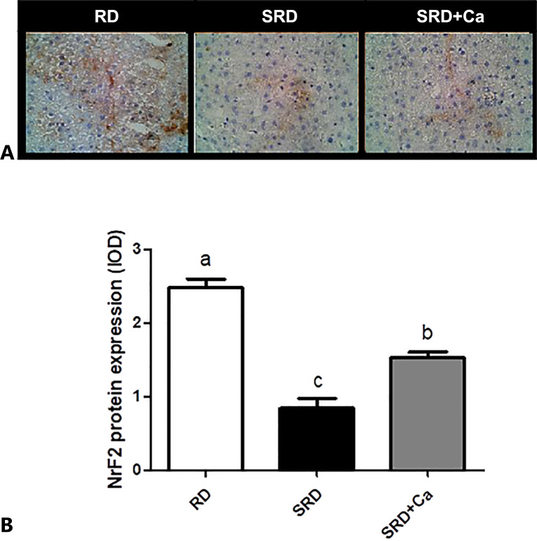 Liver NrF2 expression in rats fed a reference diet (RD), sucrose-rich diet (SRD), or SRD with cannabis oil (SRD + Ca). A Representative photomicrographs of immunocytochemical staining of NrF2 in the liver sections of rats. Decreased levels of nuclear and cytoplasmic positive markers are observed in the SRD group. ×400 magnification. B Quantitative immunohistochemical analysis of NrF2 expression in the liver. Values (mean ± SEM, n = 6) are expressed as the integrated optical density (IOD). Values are expressed as mean ± SEM, n = 6. Bars that do not share the same letter are significantly different (p < 0.05) when one variable at a time was compared by one-way ANOVA followed by Newman-Keuls test.
