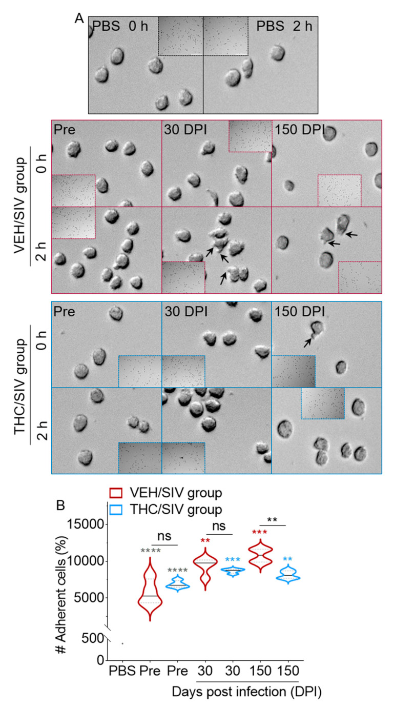 U937 spreading and adhesion to type I collagen are inhibited by THC/SIV BEVs: (A) representative images of U937 cell spreading on type I collagen following treatment with BEVs at 1000 µg/mL. The 10× magnification kinetic images were acquired at t = 0 h and t = 2 h using the Lionheart FX automated microscope. Black arrows indicate membrane protrusions. Scale bar: 50 μm. (B) Quantification of adherent monocytes incubated with 1000 µg/mL BEVs for 18 h. Full view of each well was analyzed. Ordinary one-way ANOVA (Brown–Forsythe and Bartlett tests, with Sidak’s multiple comparisons test) was used to determine the statistical significance within the group. Binary Student’s t tests (Welch’s correction) were used to determine significant differences between groups for each of the time points in each group. ** p < 0.01, *** p < 0.005, **** p < 0.001, and ns = non-significant.