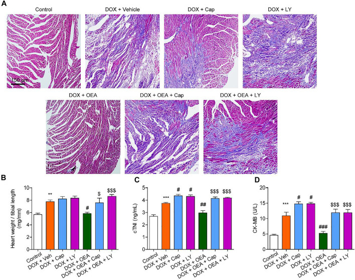 OEA attenuates DIC in mice through a PI3K-dependent pathway. Mice with or without DOX (6 mg/kg, i. v.) challenge were treated with OEA (30 mg/kg, i. v.), capsazepine (5 mg/kg, i. v.) and LY294002 (10 mg/kg, i. v.) for 14 days concurrently with DOX challenge. Heart tissues were isolated at day 15 for analysis. (A) Representative histopathological sections of heart tissues by Masson staining. The effects of OEA and LY294002 on (B) heart weight/ tibial length ratio, serum levels of (C) cTNI and (D) CK-MB in mice. Data are expressed as mean ± SEM, n = 6. ***, p < 0.001 vs. control. #, p < 0.05 vs. DOX + vehicle. $$$, p < 0.001 vs. DOX + OEA.