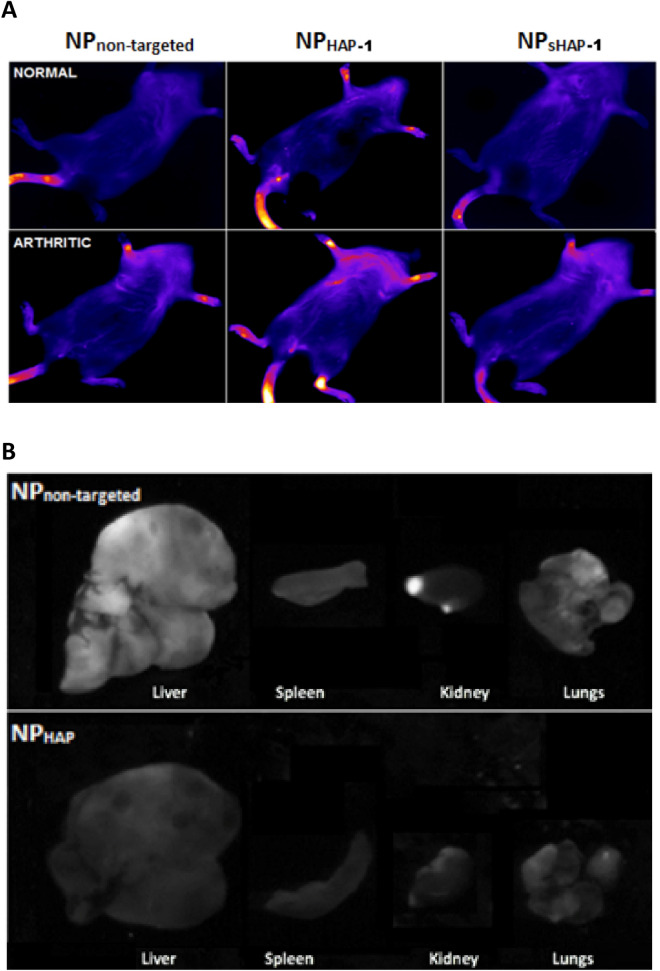 In vivo NP localization in normal and arthritic rats using near infrared imaging (NIR). (A) Localization of NPnon-targeted, NPHAP-1 and NPsHAP-1 24 h post-injection. No specific accumulation was seen in normal rats treated with NPnon-targeted and NPsHAP-1. In arthritic rats, slight accumulation to the inflamed joints was observed for NPnon-targeted and NPsHAP-1. For NPHAP1, localization to the joints was observed in both normal and arthritic rats. (B) Ex vivo imaging of liver, spleen, kidney, and lungs extracted from NPnon-targeted, NPHAP-1 rats.