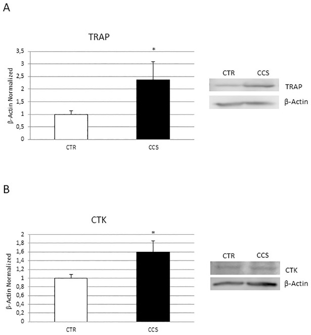 Characterization of OCs derived from CCS.TRAP (A), Cathepsin K (CTK) (B) protein expression in osteoclasts (OCs) from 5 Childhood cancer survivors (CCS) compared with OCs from 5 healthy subjects (CTR), determined by Western Blot starting from 15μg of total lysate. The most representative images are showed. The Image Studio Digits software has been used for the protein bands density detection. The intensity ratios of immunoblots compared to CTR, considered as 1, were quantified after normalization with the housekeeping protein β-Actin. Histograms represent the relative quantification for TRAP and CTK expression as mean ± SD of independent experiments on each individual sample. For statistical analysis it has been used a t-test. *Indicates p ≤ 0.05 compared to CTR.