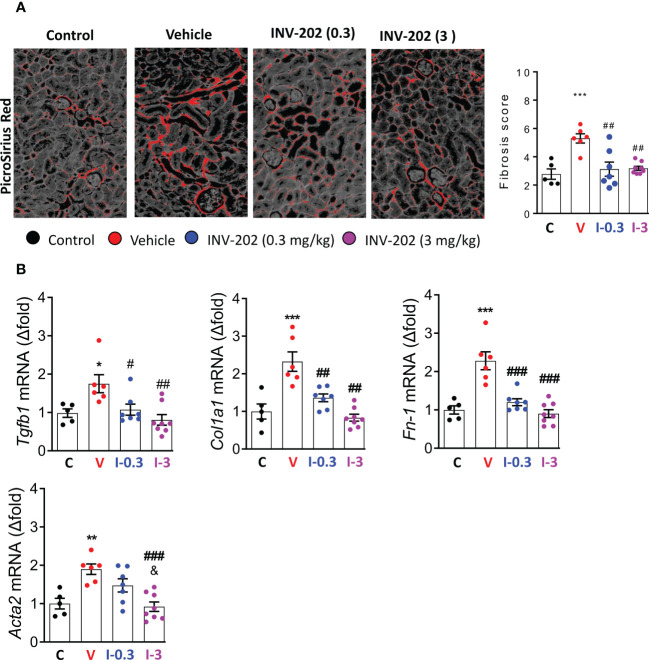 INV-202 reduces renal fibrosis. (A) Representative picro-sirius red stains of kidney slides for collagen fibers with analysis of mean fibrosis scores. (B) mRNA analysis of Tgfb1, Col1a1, Fn-1 and Acta2 coding for TGF-β, Collagen I type 1, fibronectin and α-smooth muscle actin respectively. Statistical significance versus the standard condition: *p < 0.05; **p < 0.01; ***p < 0.001; versus vehicle: #p < 0.05; ##p < 0.01; ###p < 0.001; versus INV-202 group. C: non-diabetic control mice, V: Vehicle-treated diabetic mice, I-0.3: INV-202-treated diabetic mice (0.3 mg/kg), I-3: INV-202-treated diabetic mice (3 mg/kg).