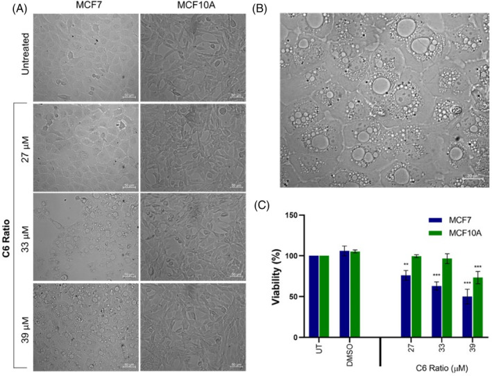 Effect of the cannabinoid ratio on cell viability and morphology. (A) Change in the morphology of the MCF7 and MCF10A cell lines after treatment with increasing concentrations of the cannabinoid ratio for 24 h and (B) the change in morphology of the MCF7 cell line after treatment with 39 μM of the cannabinoid ratio, determined using light microscopy (20× and 40× objective, scale bar = 50 μm and 20 μm). (C) Change in the viability of MCF7 and MCF10A cell lines after treatment with increasing concentrations of the cannabinoid ratio for 24 h, determined using the crystal violet assay (n = 3, data are presented as mean ± SD, *significant to untreated control; **p < 0.01; ***p < 0.001). DMSO, dimethyl sulfoxide vehicle control; UT, untreated.