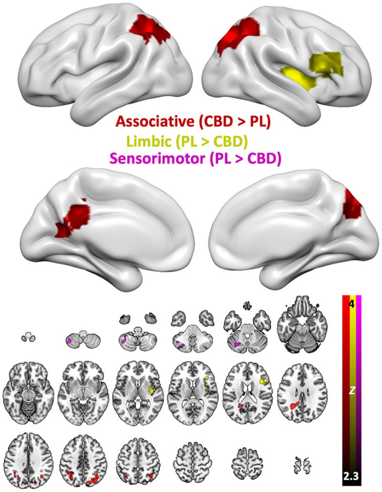 Drug effects on brain-wide connectivity with the associative (red), limbic (yellow) and sensorimotor (pink) striatum in Study 2.CBD: cannabidiol; PL: placebo.Both relative increases (CBD > PL) and decreases (PL > CBD) are shown, depending on the pattern of significant results in the three analyses. Effects on sensorimotor striatum connectivity were only seen in the left cerebellum, and are therefore not visible on the top panel, which only shows inflated views of the cortex.