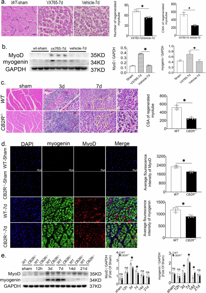 Inhibiting pyroptosis can promote skeletal muscle regeneration after injury, however, CB2R knockout impeded skeletal muscle regeneration after injury.a Cross-sectional area and number of regenerated muscle cells 7 days after skeletal muscle injury, n = 5, *p < 0.05 vs. Vehicle group. b MyoD and Myogenin protein expression levels from whole muscle tissue lysates at 7 days post-injury in mice treated with VX765 compared to the vehicle-treated group, n = 3, *p < 0.05 vs. Vehicle group. c Statistical diagram of diameter and cross-sectional area of regenerated muscle cells, n = 5, *p < 0.05 WT vs. Cb2r−/− group, large picture scale bar = 50 μm, small picture scale bar = 20 μm. d Expression levels of MyoD and Myogenin, scale bar = 20 μm, n = 5, *p < 0.05 WT vs. Cb2r−/− group. e MyoD and Myogenin protein levels after injury in WT and Cb2r−/− mice, n = 3, *p < 0.05 WT vs. Cb2r−/− group. Data are represented as mean ± SD. ns no significance.