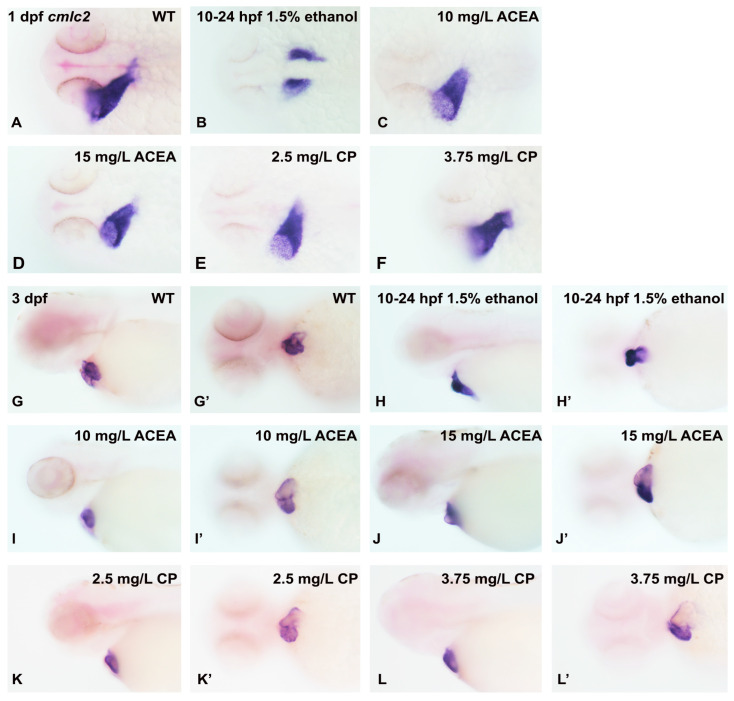 The effects of ethanol and cannabinoid exposure on the expression of the cmlc2 cardiac marker in embryonic zebrafish heart following drug exposure from 10–24 hpf. The expression of cmlc2 was examined in 1 dpf (A–F) heart (dorsal view) and 3 dpf (G–L’) heart (ventral and lateral view) following ethanol or cannabinoid exposure from 10–24 hpf. Compared to the marker expression in untreated embryos (A,G,G’), only exposure to 1.5% ethanol disrupts the normal cmlc2 expression pattern (B,H,H’), with no effects of cannabinoid exposure on expression observed at any concentrations of these agonists (C–F,I–L’). Each experiment was conducted in triplicate with an n = 20, with 60/60 embryos showing a normal cmlc2 expression pattern with no treatment or cannabinoid agonist exposure, and 0/60 embryos showing a normal cmlc2 expression pattern with ethanol exposure.