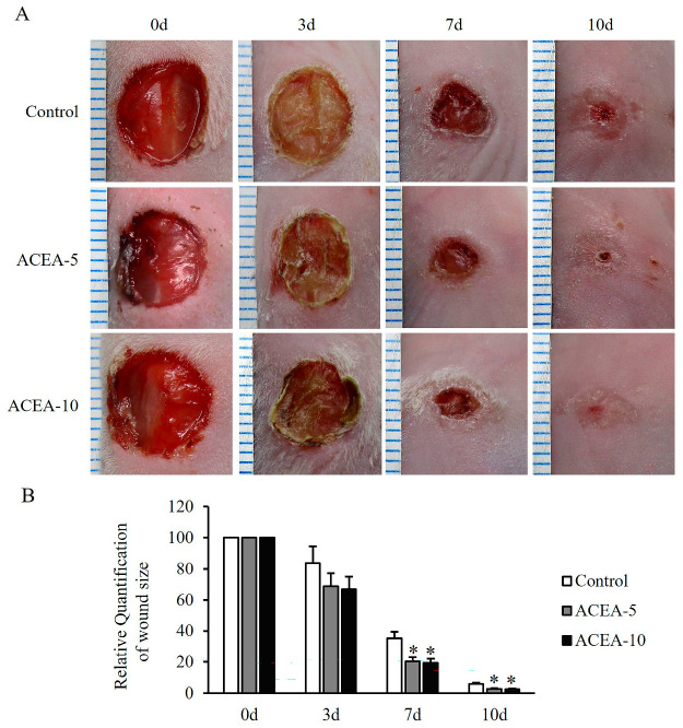 Effects of cannabinoid receptor 1 (CB1) agonist on wound contraction in a mouse full-thickness skin wound model. (A) Representative wound images were obtained on days 0, 3, 7, and 10 from mice treated daily with the CB1 agonist arachidonyl-2′-chloroethylamide at doses of 5 mg/kg or 10 mg/kg following injury. (B) Quantitative analysis of wound contraction, expressed as a percentage of the initial wound area (baseline set at 100%). Data are presented as mean ± SD, with n = 10 mice per group. * p < 0.05 vs. vehicle-treated controls, which were set at 100%.