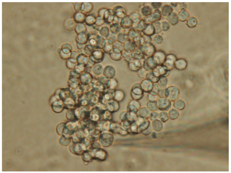 Morphology of GH3 pituitary tumor cells. Live cell imaging was captured using an inverted microscope at a magnification of ×200. The horizontal, elongated, triangle-shaped shadow in the bottom right corner indicates that the measuring electrode is approaching the cell. To perform patch-clamp recordings, the patch electrode was gradually positioned against the pituitary cells using a micromanipulator. Despite being dispersed in the recording chamber, the pituitary cells, which are slightly uniform in size, show a tendency to aggregate.