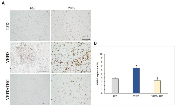 Effect of THC on MMP-2 expression: (A) representative MMP-2 expression; left column, magnification 40×; scale bar = 500 μm; right column, magnification 200×; scale bar = 100 μm; (B) % MMP-2 expression. Data are presented as mean ± SEM. *p < 0.001 vs. LFD group; #p < 0.001 vs. VHFD group.