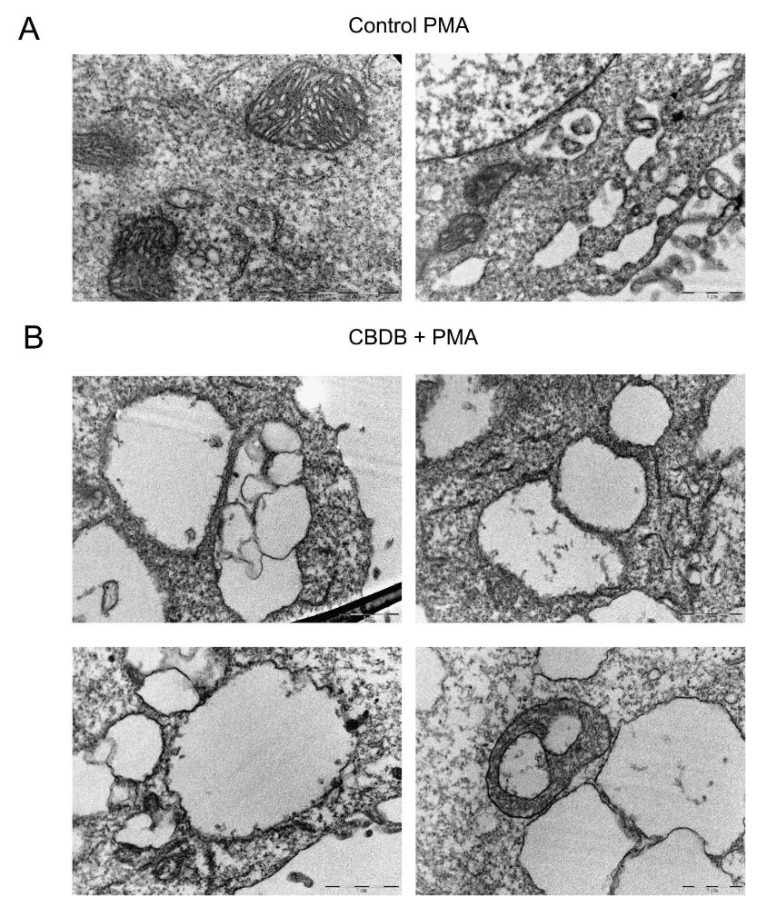Representative TEM images of cell morphology. (A) MCF-7 cells were treated with vehicle (DMSO) and PMA (100 nM), showing normal cell organelles. Scale bar 2 μm. (B) MCF-7 cells were incubated with CBDB + PMA (100 nM), highlighting the presence of cytoplasmic vacuolations related to disassembled ER and mitochondria. Scale bar 1 μm.