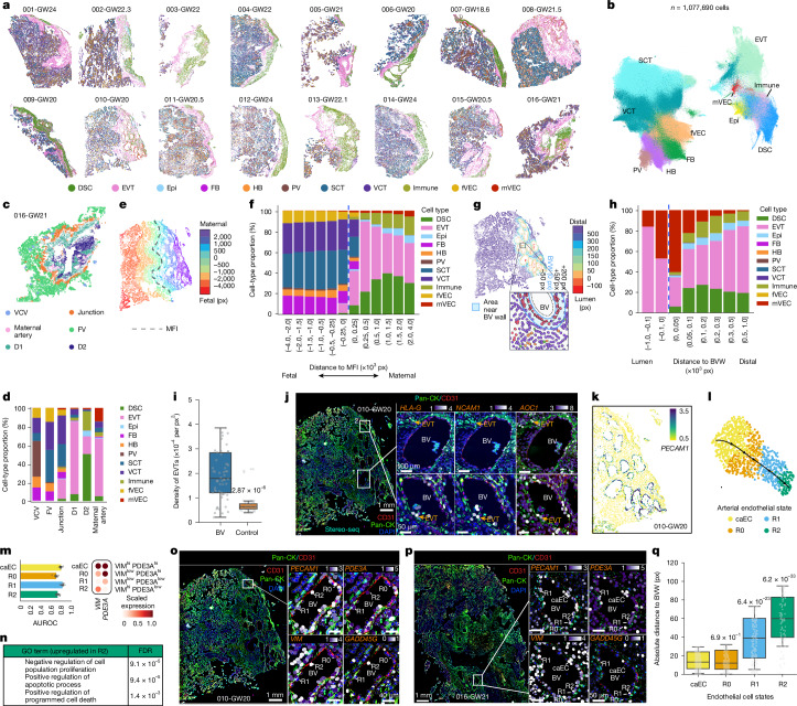 Overview of submicrometre spatial whole-transcriptome profiling at the MFI.a, STOmics Stereo-seq profiling of basal-plate sections from 16 second-trimester samples of normal pregnancy. Each dot represents a single cell, colour-coded by cell type. b, UMAP projection of around 1.1 million single-cell spatial transcriptomic profiles across 16 samples. c, Spatial cell community analysis identified six recurrent communities. D1, decidua-1; D2, decidua-2; FV, floating villus; Junction, maternal–fetal junction; VCV, villous core vessel. d, Each spatial community exhibited a characteristic cell-type composition. e, Distances (in 0.5-μm pixels) to the MFI for each cell. Positive distances are maternal; negative distances are fetal. px, pixels. f, Cell-type proportions binned across the MFI. g, Spatial distances (in 0.5-μm pixels) to the nearest blood vessel (BV) wall in the decidua. Positive, intraluminal; negative, extraluminal. h, Cell-type proportion in decidua by proximity to blood vessel walls (BVWs). i, Quantification of EVT density adjacent to blood vessel walls (n = 62) compared to randomized decidual regions of same size. In box plots, the centre line is the median, box represents the IQR, and whiskers show minima and maxima (0.5× IQR) end-points. P value, two-tailed Wilcoxon rank-sum test. j, Two representative spiral arteries at distinct phases of EVT-mediated remodelling, visualized by joint immunostaining and spatial transcriptomics. Box 1, early stage; box 2, advanced. k, Spiral artery cross-sections (n = 17) with PECAM1+ endothelial cells illustrating active EVT invasion in a representative GW20 sample. l, Single-cell transcriptomic profiling revealed endothelial state transitions: caEC → R0 → R1 → R2. m, PDE3A and VIM distinguished R0–R2 states with high accuracy (n = 10 bootstrap replications). Bars show mean area under the receiver operating characteristic curve (AUROC) and error bars represent s.d. n, R2 endothelial cells are enriched for apoptosis-related genes. o,p, R0–R2 endothelial states in samples 010-GW20 (o) and 016-GW21 (p) were independently validated via paired spatial transcriptomics and pan-CK and CD31 immunostaining. Fields from one representative sample. q, Absolute pixel distances of endothelial states to the vessel walls from 17 remodelling spiral arteries (010-GW20). In box plots, the centre line is the median, box represents the IQR, and whiskers show minima and maxima (0.5× IQR) end-points. P values, two-tailed Wilcoxon rank-sum test after Benjamini–Hochberg correction.Source data