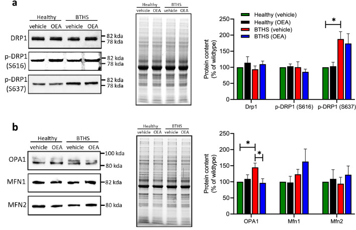 OEA treatment attenuated the elevated expression levels of OPA1 in BTHS lymphoblasts. Representative immunoblots (left panel), images of total protein loading (middle panel), and quantification (right panel) of proteins involved in mitochondrial fission (a) and fusion (b) are shown. Quantification was determined by Image Lab software (Bio-Rad Canada) and shown normalized to total protein. Uncropped images are presented in Supplementary Figs. S1–S6. Data are means ± S.E.M; n = 5. *P < 0.05.