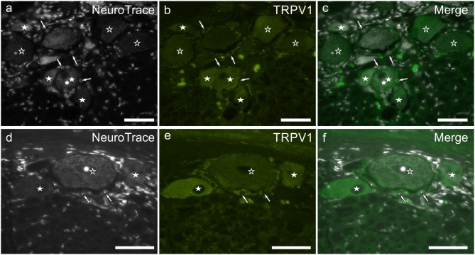 (a–f) Photomicrographs of cryosections of the C8 cervical dorsal root ganglia belonging to two aged dogs showing transient receptor potential vanilloid type 1 (TRPV1) immunoreactivity. White stars indicate neurons showing bright TRPV1 immunoreactivity, while open stars indicate larger neurons showing weaker TRPV1 immunoreactivity. Arrows indicate the Neurotrace labeled nuclei of satellite glial cells showing bright TRPV1 immunolabeling (b,e). Bar: a–f = 50 μm.