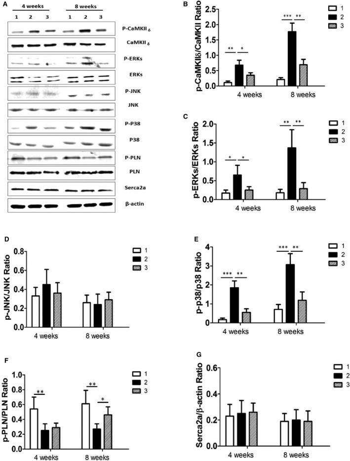 Therapeutic effect of CPZ in TAC‐induced cardiac hypertrophy by inhibiting the CaMKII δ–MAPK signaling pathway in vivo. A, Expression of proteins were analyzed by Western blotting for CaMKII δ, ERKs, p38, JNK, PLN, and Serca2a in the sham‐operated group (panel 1), the TAC group (panel 2), and the group treated with CPZ 2.5 mg/kg per day (panel 3). In the TAC group at 4 or 8 weeks after TAC operation, β‐actin was used as an internal control. Relative expression ratios of p‐CaMKII δ to CaMKII δ (B), p‐ERKs to ERKs(C), p‐JNK to JNK(D), p‐p38 to p38 (E), p‐PLN to PLN (F), and Serac2a to β‐actin (G) in left ventricle tissue from the above groups (6 independent experiments per group) are shown. *P<0.05, **P<0.01, ***P<0.001. CaMKII indicates calmodulin‐dependent protein kinase II; CPZ, capsazepine; ERK, extracellular signal–regulated kinase; JNK, c‐Jun N‐terminal kinase; p, phosphorylated; p, phosphorylated; PLN, phospholamban; TAC, transverse aorta constriction.