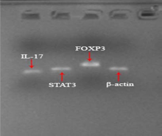 The RNA integrity of genes including interleukin (IL)-17, signal transducer and activator of transcription factor3 (STAT3), Forkhead box P3 (FOXP3+), and β-actin2 evaluated by agarose gel electrophoresis with ladder 50 bp (left to right).